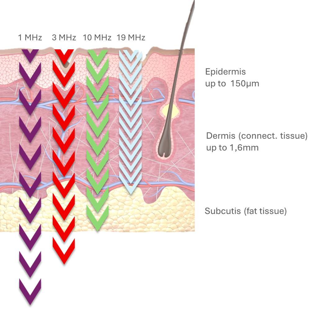 Eindringtiefen_engl_Neu